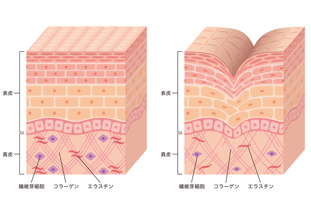 コラーゲン肌断面図